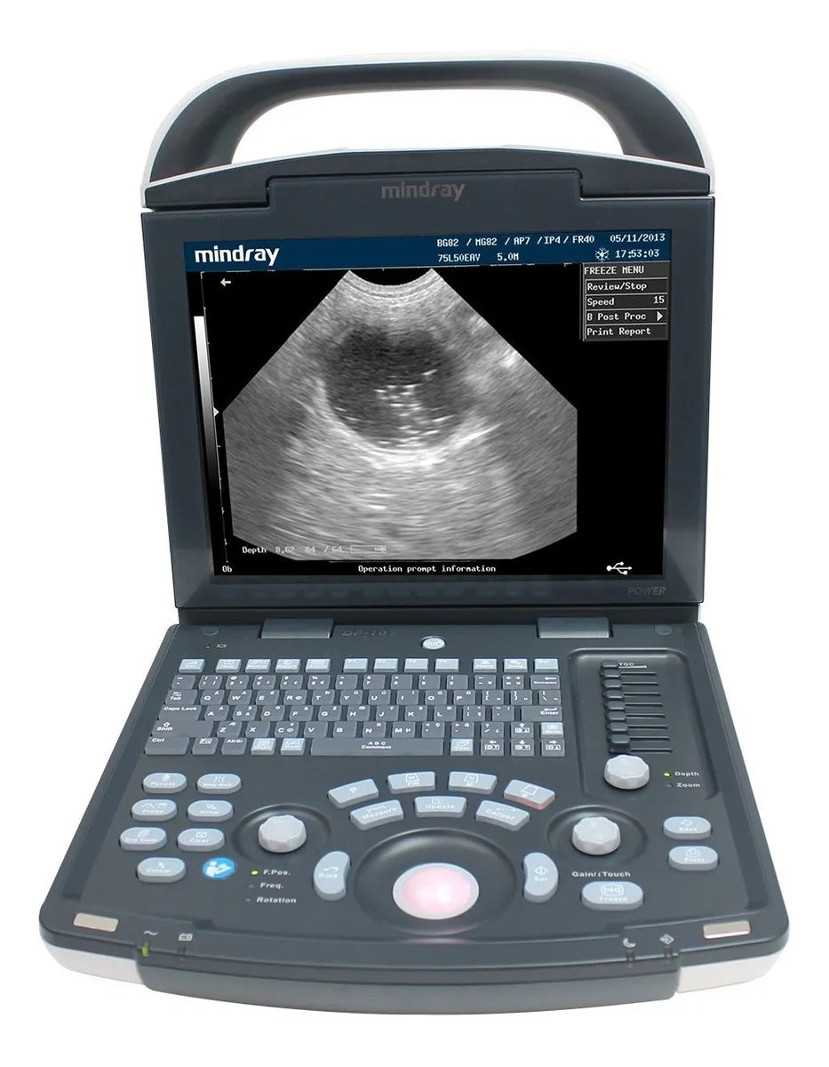 Ultrasonido Portátil para Uso Humano Modelo DP20 con transductores convexo + lineal | Marca Mindray