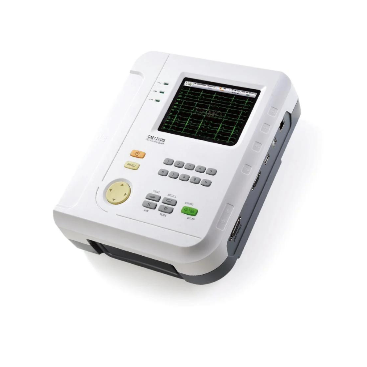 Monitor Veterinario CM1200B‑V – ECG 12 Canales, Pantalla 5.7″, Batería Interna | Marca COMEN