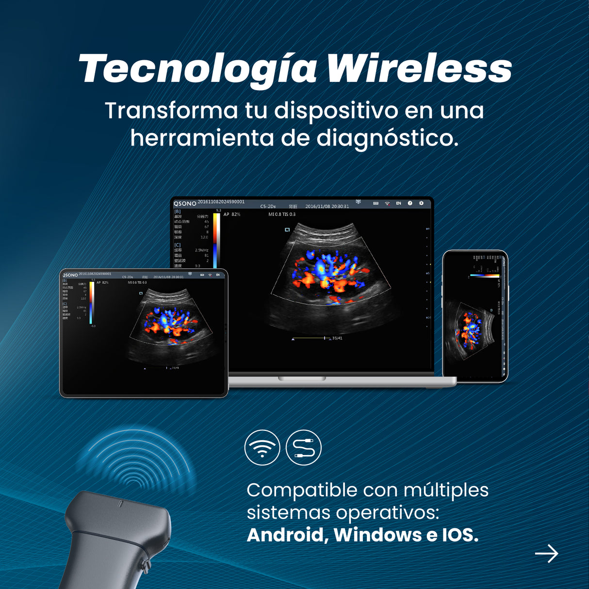 Ultrasonido Portátil INTEGRA II