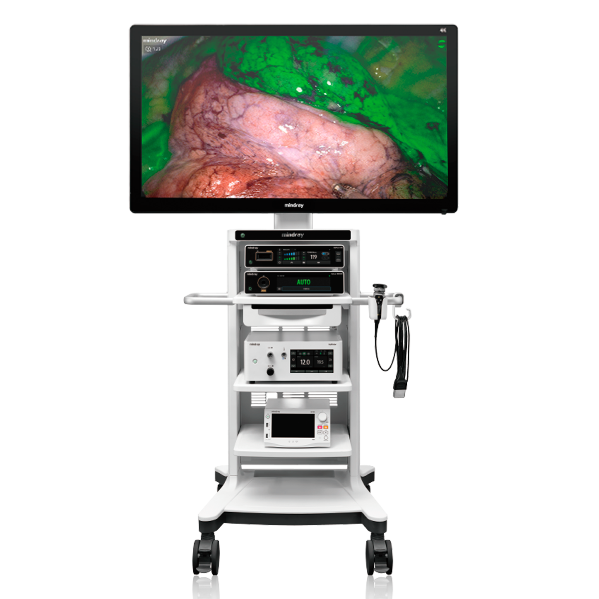 Torre de Laparoscopia con Pantalla de 55 pulgadas 4K modelo UX5 | Marca Mindray