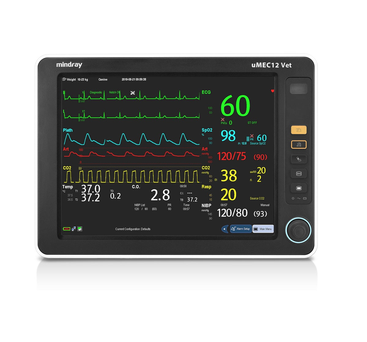 Monitor de Paciente Veterinario uMEC12 – NIBP, SpO₂, ECG, CO₂, Batería Interna | Mindray
