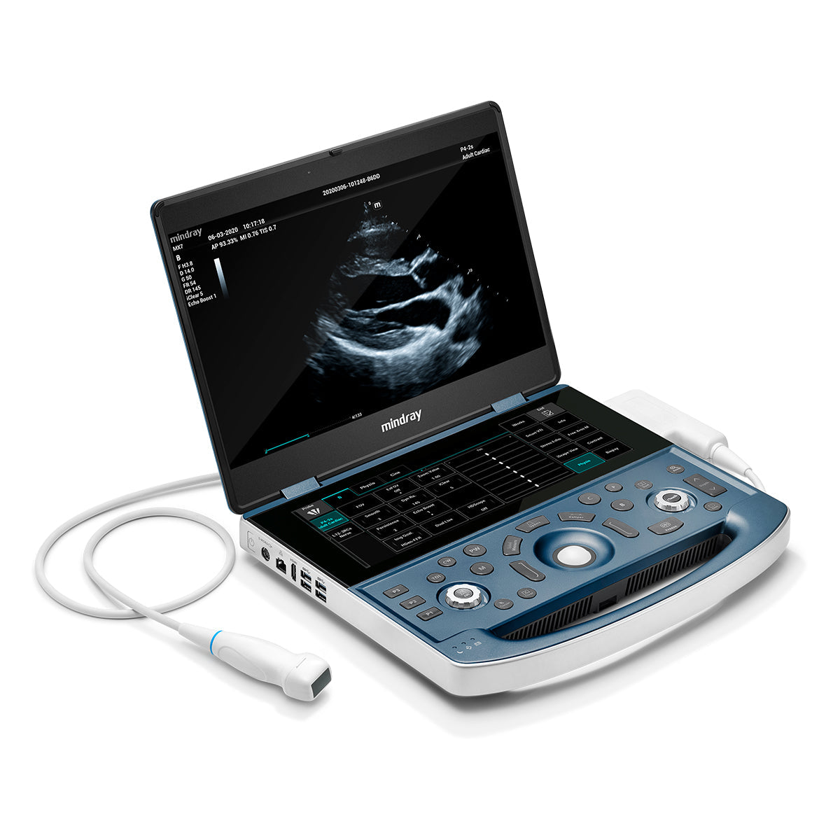 Equipo de Ultrasonido Portátil MX7 | Mindray