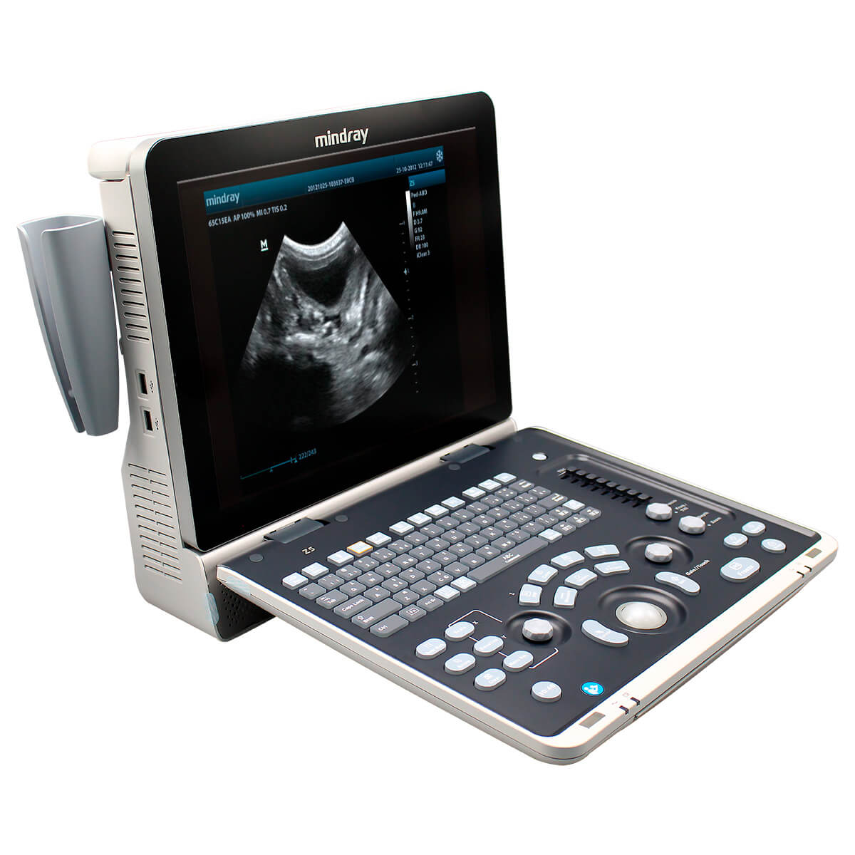 Ultrasonido Portátil de ecografía para uso humano Z50 con monitor de 15″ | Marca Mindray