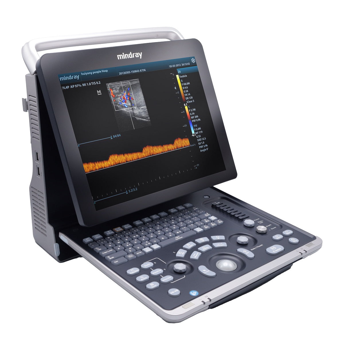 Equipo de ultrasonido 4D portátil de ecografía para uso humano Z60 con pantalla 15″ | Marca Mindray