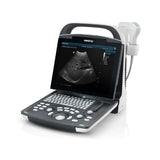 Ultrasonido Portátil para Uso Humano Modelo DP20 con transductores convexo + lineal | Marca Mindray